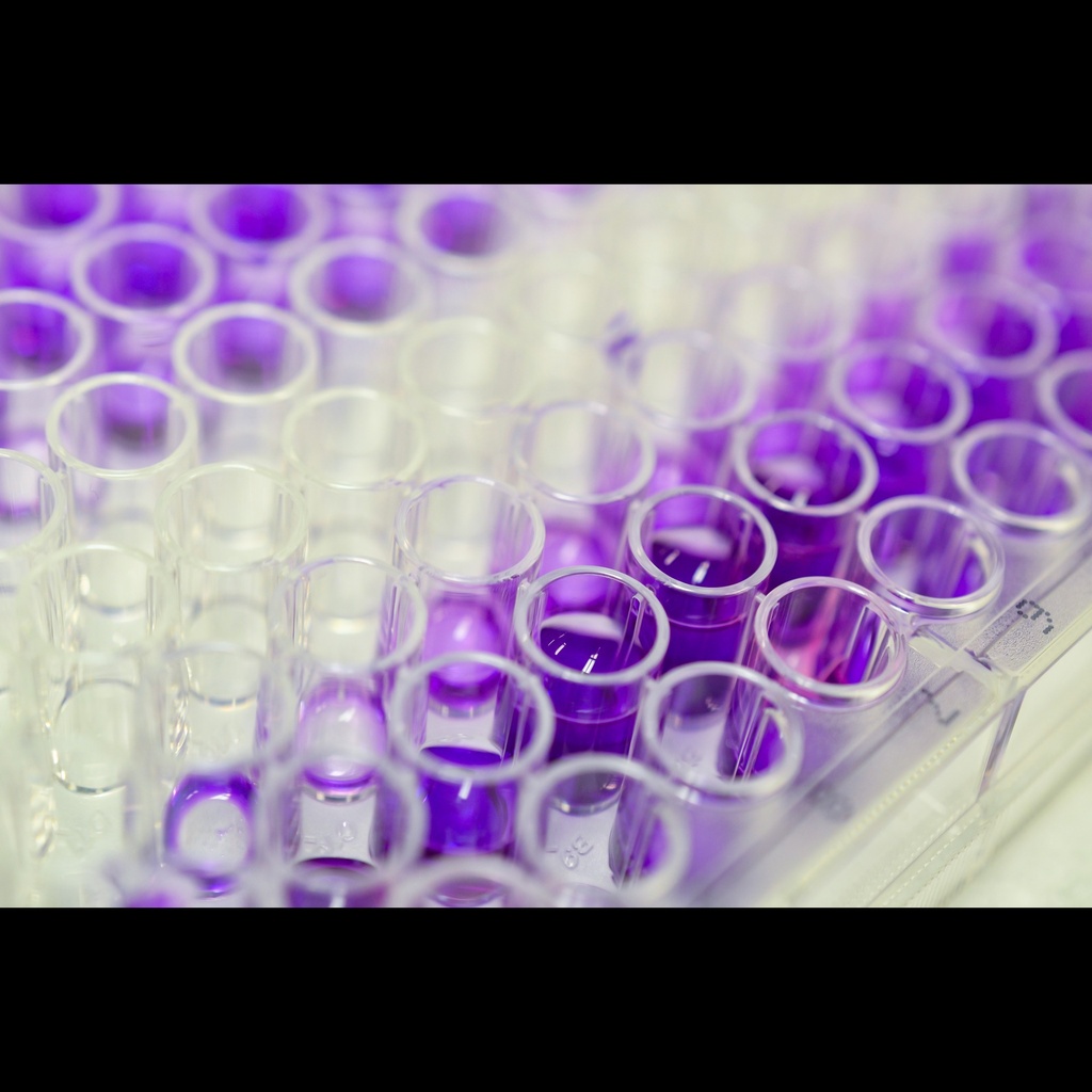 COL4A4 elisa kit :: Human Collagen alphasize:4  4  chain, COL4A4 ELISA Kit, 96 T
